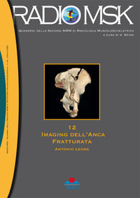 9788897162872 - Imaging dell'anca fratturata